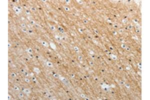 The image on the left is immunohistochemistry of paraffin-embedded Human brain tissue using ABIN7189659(ADAMTS19 Antibody) at dilution 1/25, on the right is treated with synthetic peptide. (ADAMTS19 Antikörper)