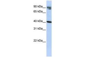 KLHDC8A Antikörper  (C-Term)