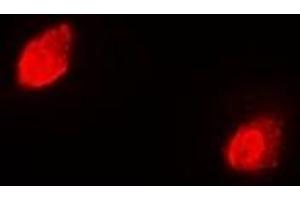 Immunofluorescent analysis of RACK1 staining in Hela cells. (GNB2L1 Antikörper)