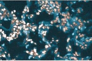 Immunohistochemical staining of a rabbit lung section.