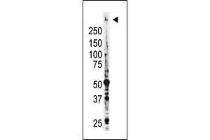 Image no. 2 for anti-Myeloid/lymphoid Or Mixed-Lineage Leukemia (MLL) (C-Term) antibody (ABIN356674) (MLL/KMT2A Antikörper  (C-Term))