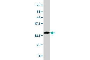 Western Blot detection against Immunogen (34. (FOXC2 Antikörper  (AA 421-501))