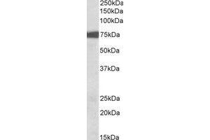 Western Blotting (WB) image for anti-Ribosomal Protein S6 Kinase, 90kDa, Polypeptide 2 (RPS6KA2) (C-Term) antibody (ABIN2464829) (RPS6KA2 Antikörper  (C-Term))