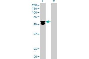 Western Blot analysis of KLHDC4 expression in transfected 293T cell line by KLHDC4 MaxPab polyclonal antibody. (KLHDC4 Antikörper  (AA 1-520))