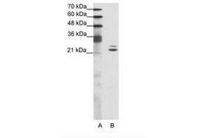 Image no. 1 for anti-BUD31 Homolog (BUD31) (AA 71-120) antibody (ABIN202030) (BUD31 Antikörper  (AA 71-120))