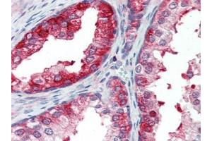 Human Prostate (formalin-fixed, paraffin-embedded) stained with SKP2at 10 µg/ml followed by biotinylated goat anti-rabbit IgG secondary antibody, alkaline phosphatase-streptavidin and chromogen. (SKP2 Antikörper  (AA 221-425))