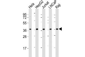 All lanes : Anti-DFFB Antibody (N-term) at 1:2000 dilution Lane 1: Hela whole cell lysates Lane 2: HepG2 whole cell lysates Lane 3: Jurkat whole cell lysates Lane 4: LNCaP whole cell lysates Lane 5: Raji whole cell lysates Lysates/proteins at 20 μg per lane. (DFFB Antikörper  (N-Term))