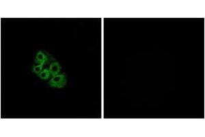 Immunofluorescence analysis of A549 cells, using LSHR Antibody. (LHCGR Antikörper  (AA 621-670))