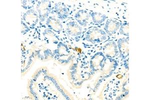 Immunohistochemistry (Paraffin-embedded Sections) (IHC (p)) image for anti-Mucosal Vascular Addressin Cell Adhesion Molecule 1 (MADCAM1) antibody (ABIN7074695)