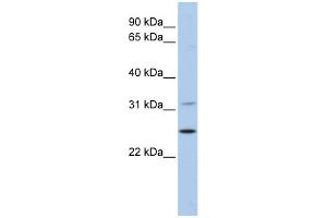 WB Suggested Anti-DHRS1 Antibody Titration: 0. (DHRS1 Antikörper  (N-Term))