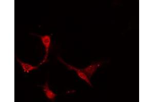 ABIN6274159 staining A549 cells by IF/ICC. (TACSTD2 Antikörper  (Internal Region))
