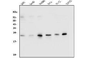 Western blot analysis of Rab9/RAB9A using anti-Rab9/RAB9A antibody (ABIN7601611).