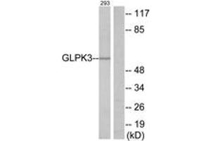 Western blot analysis of extracts from 293 cells, using GK3 Antibody.