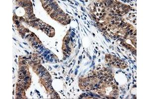 Immunohistochemistry (IHC) image for anti-Proteasome (Prosome, Macropain) 26S Subunit, ATPase, 3 (PSMC3) antibody (ABIN1501331) (PSMC3 Antikörper)
