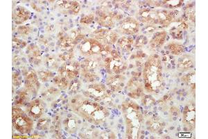 Formalin-fixed and paraffin embedded mouse kidney labeled with Rabbit Anti DAB2 Polyclonal Antibody, Unconjugated (ABIN760961) at 1:200 followed by conjugation to the secondary antibody and DAB staining (DAB2 Antikörper  (AA 31-130))