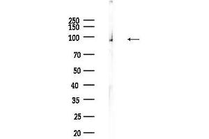 Western blot analysis of lysates from Mouse testis, using Phospho-NF kappaB p100/p52 (Ser870) Antibody at 1/1000 dilution.