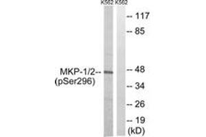 Western blot analysis of extracts from K562 cells treated with heat shock , using MKP-1/2 (Phospho-Ser296/318) Antibody. (MKP-1/2 Antikörper  (pSer296))