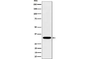 Western blot analysis of TSFM expression in Jurkat cell lysate. (Rekombinanter TSFM Antikörper)
