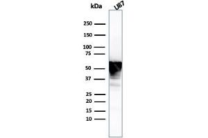 Western Blot Analysis of U87 cell lysate using Vimentin Mouse Monoclonal Antibody (VIM/3736). (Vimentin Antikörper  (AA 2-466))