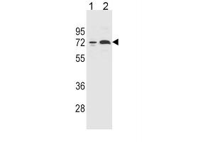 Western Blotting (WB) image for anti-Cytochrome P450, Family 2, Subfamily B, Polypeptide 6 (CYP2B6) antibody (ABIN2996016) (CYP2B6 Antikörper)