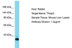 Host: Rabbit Target Name: THRAP3 Sample Tissue: Mouse Liver Antibody Dilution: 1ug/ml