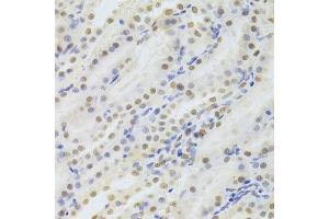 Immunohistochemistry (Paraffin-embedded Sections) (IHC (p)) image for anti-Hepatoma-Derived Growth Factor (HDGF) (AA 1-240) antibody (ABIN6141694)