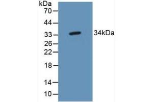 Detection of TP53TG5 in Mouse Brain Tissue using Polyclonal Antibody to TP53 Target Gene 5 (TP53TG5) (TP53TG5 Antikörper  (AA 190-262))