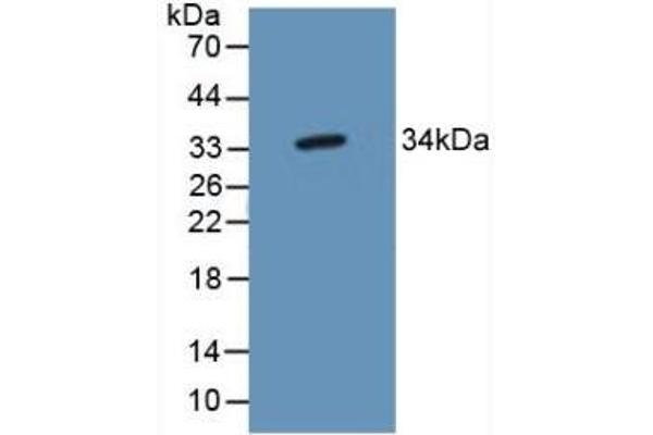 TP53TG5 anticorps  (AA 190-262)