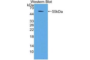 Western Blotting (WB) image for anti-Apoptosis Antagonizing Transcription Factor (AATF) (AA 240-438) antibody (ABIN2118159) (AATF Antikörper  (AA 240-438))