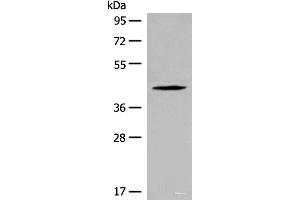 Western blot analysis of Jurkat cell lysate using QTRT1 Polyclonal Antibody at dilution of 1:450 (QTRT1 Antikörper)