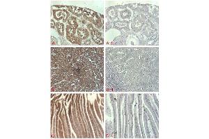 Immunohistochemical staining of of human tissue using anti-DLL1 (human), pAb  at 1:500 dilution. (DLL1 Antikörper)