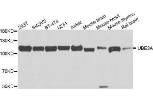Western blot analysis of extracts of various cell lines, using UBE3A antibody (ABIN5975332) at 1/1000 dilution. (ube3a Antikörper)