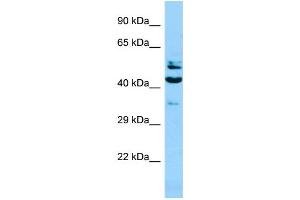 WB Suggested Anti-SH2D4A Antibody Titration: 1. (SH2D4A Antikörper  (N-Term))