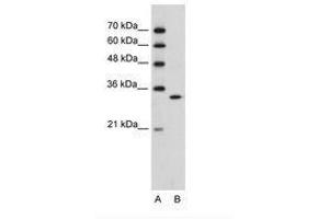 Image no. 2 for anti-Ribonuclease H2, Subunit A (RNASEH2A) (C-Term) antibody (ABIN6736313) (RNASEH2A Antikörper  (C-Term))