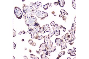 IHC analysis of CLPX using anti-CLPX antibody . (CLPX Antikörper  (AA 337-574))