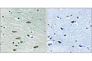 Immunohistochemistry (IHC) image for anti-Insulin-Like Growth Factor 1 Receptor (IGF1R) (AA 1311-1360) antibody (ABIN1533056)