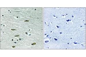 Immunohistochemistry analysis of paraffin-embedded human brain tissue, using IGF1R (Ab-1346) Antibody. (IGF1R Antikörper  (AA 1311-1360))