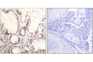 Immunohistochemistry analysis of paraffin-embedded human placenta, using GTPase Activating Protein (Phospho-Ser387) Antibody. (RACGAP1 Antikörper  (pSer387))