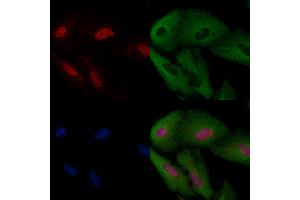 ABIN6257335 and ABIN6274168 staining  cells by IF/ICC.