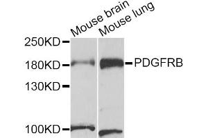 Western blot analysis of extracts of various cell lines, using PDGFRB antibody (ABIN5971206) at 1/1000 dilution. (PDGFRB Antikörper)