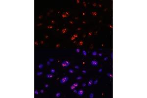 Immunofluorescence analysis of U-2 OS cells using DKC1 antibody (ABIN6127762, ABIN6139635, ABIN6139636 and ABIN6216722) at dilution of 1:100. (DKC1 Antikörper  (AA 1-180))