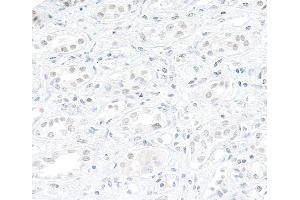 Immunohistochemistry (IHC) image for anti-ATP-Dependent RNA Helicase A (DHX9) (AA 200-250) antibody (ABIN7454523) (DHX9 Antikörper  (AA 200-250))