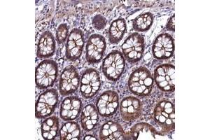 Immunohistochemical staining of human colon with TMC5 polyclonal antibody  shows moderate cytoplasmic, membranous and nuclear positivity in glandular cells at 1:50-1:200 dilution. (Tmc5 Antikörper)