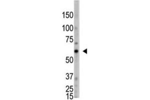 Western Blotting (WB) image for anti-2'-5'-Oligoadenylate Synthetase-Like (OASL) antibody (ABIN3002561) (OASL Antikörper)