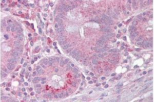 Immunohistochemistry with Small intestine tissue at an antibody concentration of 5µg/ml using anti-SLC13A2 antibody (ARP43864_P050) (SLC13A2 Antikörper  (Middle Region))