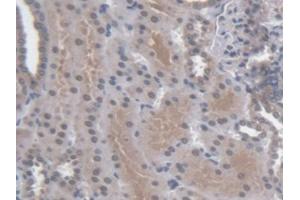 DAB staining on IHC-P; Samples: Human Kidney Tissue (Regucalcin Antikörper  (AA 65-299))