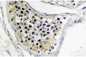 Immunohistochemistry (IHC) analyzes of CNOT4 antibody in paraffin-embedded human testis tissue. (CNOT4 Antikörper)