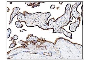 IHC analysis of CD39/ENTPD1 using anti-CD39/ENTPD1 antibody (ABIN7602461). (CD39 Antikörper  (AA 79-411))