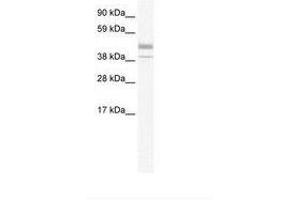 Image no. 1 for anti-Estrogen-Related Receptor beta (ESRRB) (N-Term) antibody (ABIN6735991) (ESRRB Antikörper  (N-Term))