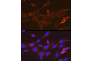 Immunofluorescence analysis of NIH-3T3 cells using T Rabbit mAb (ABIN7270916) at dilution of 1:100 (40x lens). (TACC3 Antikörper)